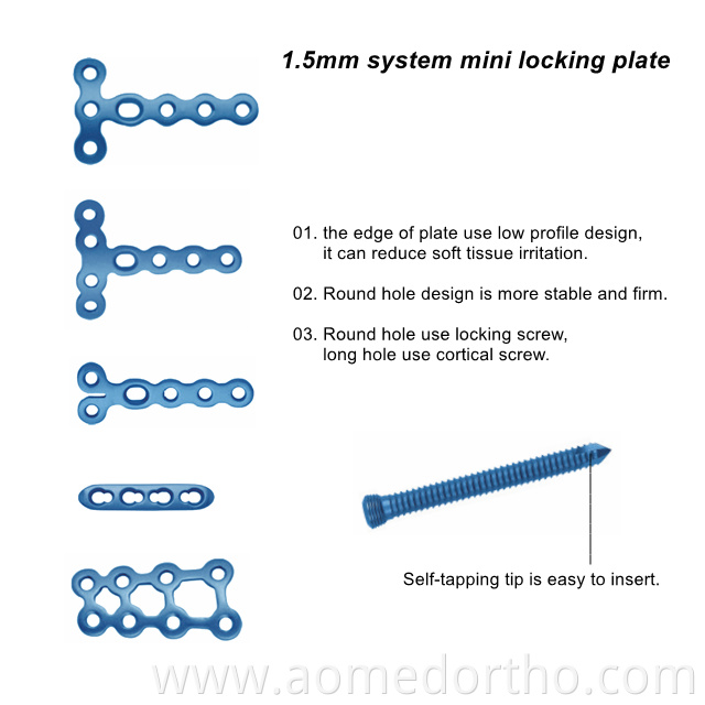 1.5mm locking plate system
